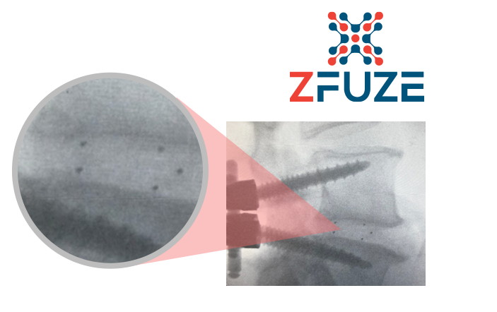 ZFUZE xray